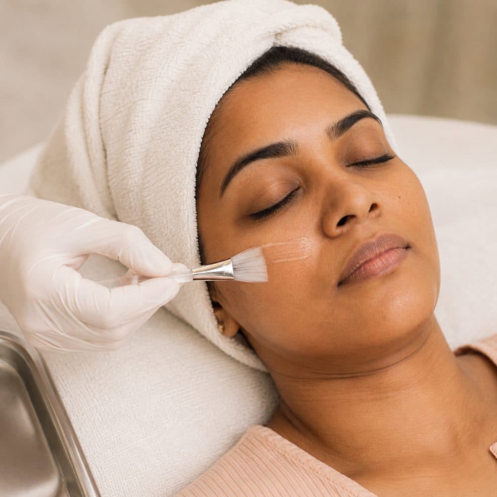 A gloved hand brushing peel solution across a patient's cheek.